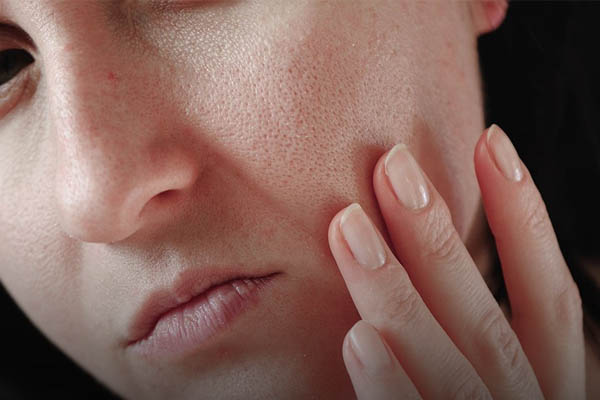 درمان منافذ باز پوست: 11 روش خانگی درمان رزونه پوست باز