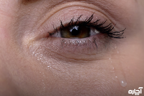 درمان اشک چشم