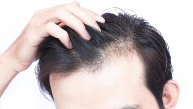 تأثیر هورمون‌ها بر رشد و ریزش مو