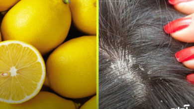 محلول ضد قارچ سر با لیمو